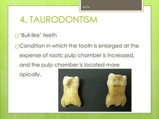 Bull Tooth 4. Developmental Disturbances.ppt of teeth x | PPTX