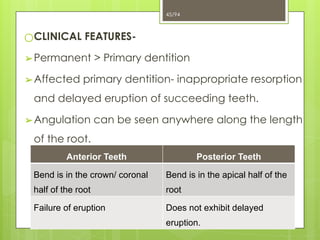 4. Developmental Disturbances.ppt of teeth x | PPTX