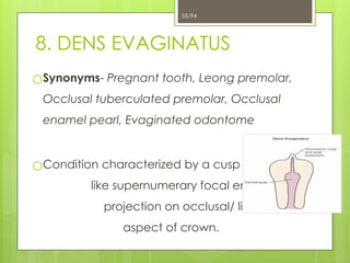 4. Developmental Disturbances.ppt of teeth x | PPTX