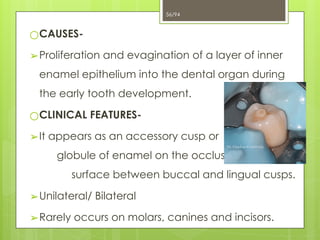 4. Developmental Disturbances.ppt of teeth x | PPTX