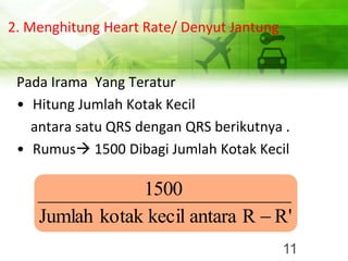 2. Menghitung Heart Rate/ Denyut Jantung
Pada Irama Yang Teratur
• Hitung Jumlah Kotak Kecil
antara satu QRS dengan QRS berikutnya .
• Rumus→ 1500 Dibagi Jumlah Kotak Kecil
11
R'
R
antara
kecil
kotak
Jumlah
1500
−
 