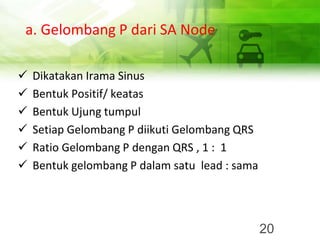 a. Gelombang P dari SA Node
✓ Dikatakan Irama Sinus
✓ Bentuk Positif/ keatas
✓ Bentuk Ujung tumpul
✓ Setiap Gelombang P diikuti Gelombang QRS
✓ Ratio Gelombang P dengan QRS , 1 : 1
✓ Bentuk gelombang P dalam satu lead : sama
20
 
