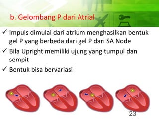 b. Gelombang P dari Atrial
✓ Impuls dimulai dari atrium menghasilkan bentuk
gel P yang berbeda dari gel P dari SA Node
✓ Bila Upright memiliki ujung yang tumpul dan
sempit
✓ Bentuk bisa bervariasi
23
 