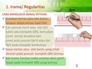 1. Irama/ Regularitas
CARA MENGUKUR IRAMA/ RYTHME
✓ Gunakan kertas atau alat bantu ,
letakan diatas kertas hasil EKG
✓ Cari puncak Gel R atau Gel Q/S
salah satu komplek QRS, kemudian
coret kertas tersebut dan
coret pula puncak Gel R atau Gel
Q/S pada komplek berikutnya
✓ Geser kertas atau alat bantu yang telah
dicoret pada puncak komplek QRS lainnya
✓ Bila Irama Teratur maka coretan akan jatuh
tepat pada Komplek QRS yang lainnya
3
 
