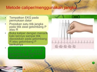 4
© 2013 The McGraw-Hill Companies, Inc. All rights reserved.
Fast & Easy ECGs, 2E
Metode caliper/menggunakan jangka
• Tempatkan EKG pada
permukaan datar
• Posisikan satu titik jangka
pada titik awal gelombang P
atau R
• Buka kaliper dengan menarik
kaki lainnya sampai titik
diposisikan pada gelombang
R atau gelombang P
berikutnya
• Dengan jangka terbuka itu ,
pindahkan ke titik puncak
gelombang P berikutnya
atau gelombang R
I
 