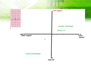 WHAT IS THIS
TOPIC ABOUT?
• 1. • 2.
Despite being red, Mars is actually a
cold place. It’s full of iron oxide dust,
which gives the planet its reddish
cast
Venus has a beautiful name and is
the second planet from the Sun. It’s
terribly hot and its atmosphere is
extremely poisonous
 
