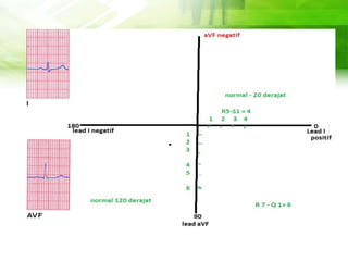 DEFINITION OF CONCEPTS
Despite being red, Mars is
actually a cold place
MARS
Venus is the second planet
from the Sun
VENUS
Saturn is composed mostly of
hydrogen and helium
SATURN
Mercury is the smallest planet
in the Solar System
MERCURY
 