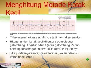 5
© 2013 The McGraw-Hill Companies, Inc. All rights reserved.
Fast & Easy ECGs, 2E
Menghitung Metode Kotak
Kecil
• Tidak memerlukan alat khusus tapi memakan waktu.
• Hitung jumlah kotak kecil di antara puncak dua
gelombang R berturut-turut (atau gelombang P) dan
bandingkan dengan interval R-R (atau P-P) lainnya.
• Jika jumlahnya sama, irama teratur , kalau tidak itu
irama tidak teratur
I
 
