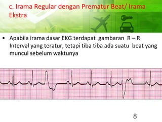c. Irama Regular dengan Prematur Beat/ Irama
Ekstra
• Apabila irama dasar EKG terdapat gambaran R – R
Interval yang teratur, tetapi tiba tiba ada suatu beat yang
muncul sebelum waktunya
8
 
