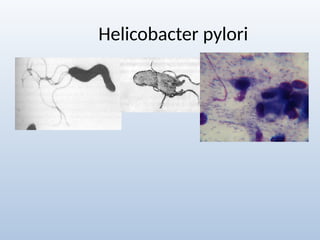 Helicobacter pylori
 