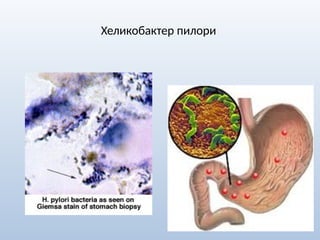 Хеликобактер пилори
 
