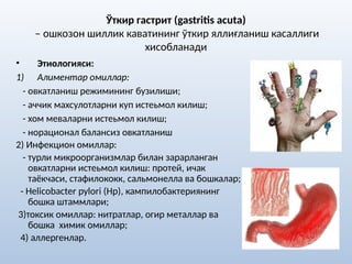 Ўткир гастрит (gastritis acuta)
– ошкозон шиллик каватининг ўткир яллиғланиш касаллиги
хисобланади
• Этиологияси:
1) Алиментар омиллар:
- овкатланиш режимининг бузилиши;
- аччик махсулотларни куп истеьмол килиш;
- хом меваларни истеьмол килиш;
- норационал балансиз овкатланиш
2) Инфекцион омиллар:
- турли микроорганизмлар билан зарарланган
овкатларни истеьмол килиш: протей, ичак
таёкчаси, стафилококк, сальмонелла ва бошкалар;
- Helicobacter pylori (Hp), кампилобактериянинг
бошка штаммлари;
3)токсик омиллар: нитратлар, огир металлар ва
бошка химик омиллар;
4) аллергенлар.
 