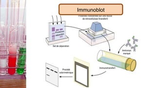 Immunoblot
 
