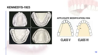 Applegate Classification 4.Classification System for Partial Edentulism.pptx