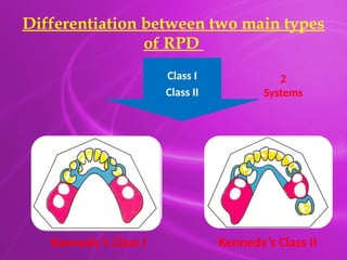 Wave Rpd System 23.7.25 Principles & Designing of RPD.pptx