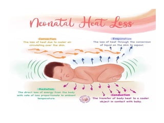 Comprehensive Overview of Neonatal Hypothermia: Causes, Types, and ...