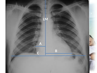 Comprehensive Radiology of the Thorax: Imaging Techniques and ...