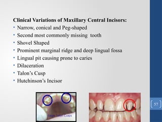Comprehensive Overview of Tooth Morphology and Its Role in Restorative ...