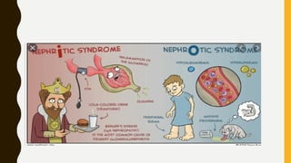 Comprehensive Overview of Nephrotic and Nephritic Syndromes: Causes ...