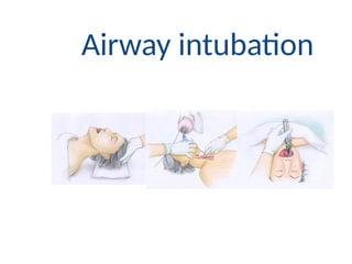Comprehensive Guide to Emergency Airway Management and Patient Care | PPTX