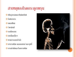 สาเหตุของโรคกระดูกพรุน
 พันธุกรรมและยีนผิดปกติ

 โภชนาการ

 แคลเซียม

 วิตามินดี

 เอสโตรเจน

 ฮอร์โมนอืนๆ
           ่
 ขาดการออกกาลัง

 ยาบางชนิด แอลกอฮอล์ และบุหรี่
 การผ่าตัดและโรคบางชนิด
 