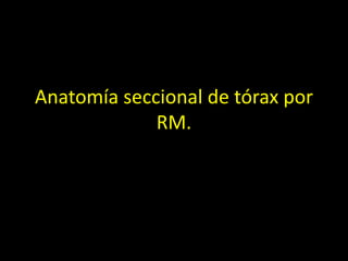 Anatomía seccional de tórax por
RM.
 