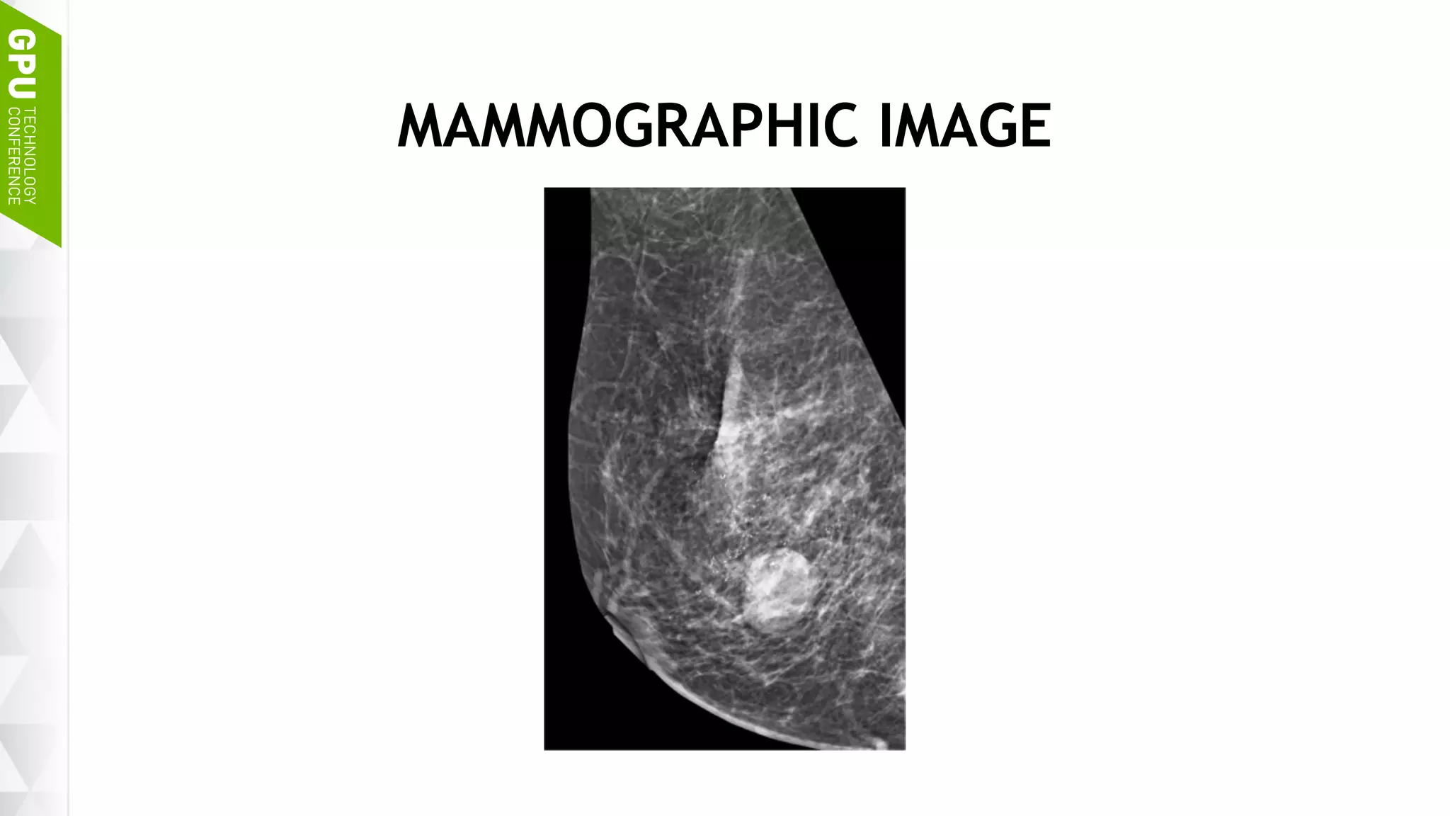 28
MAMMOGRAPHIC IMAGE
 