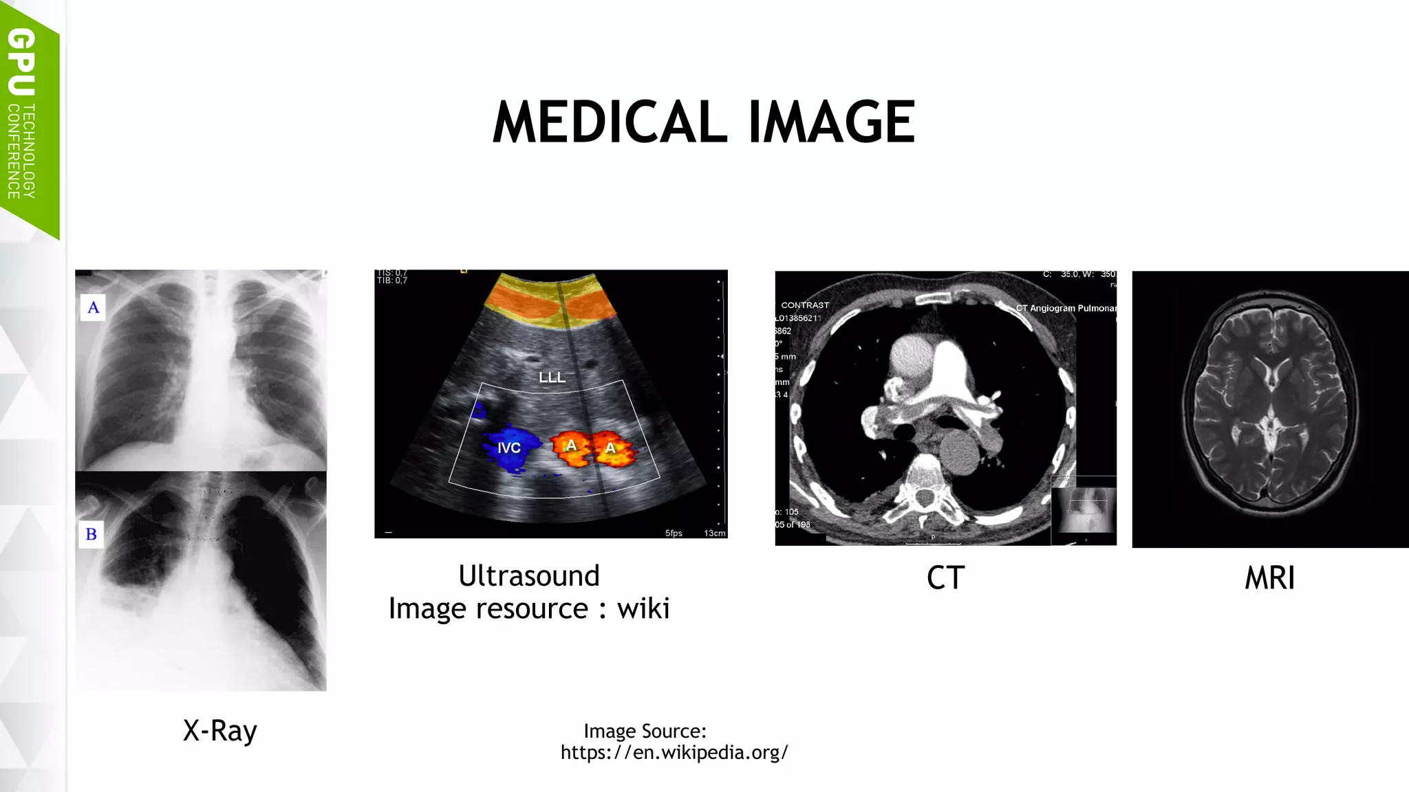 4
MEDICAL IMAGE
X-Ray
Ultrasound
Image resource : wiki
CT MRI
Image Source:
https://en.wikipedia.org/
 