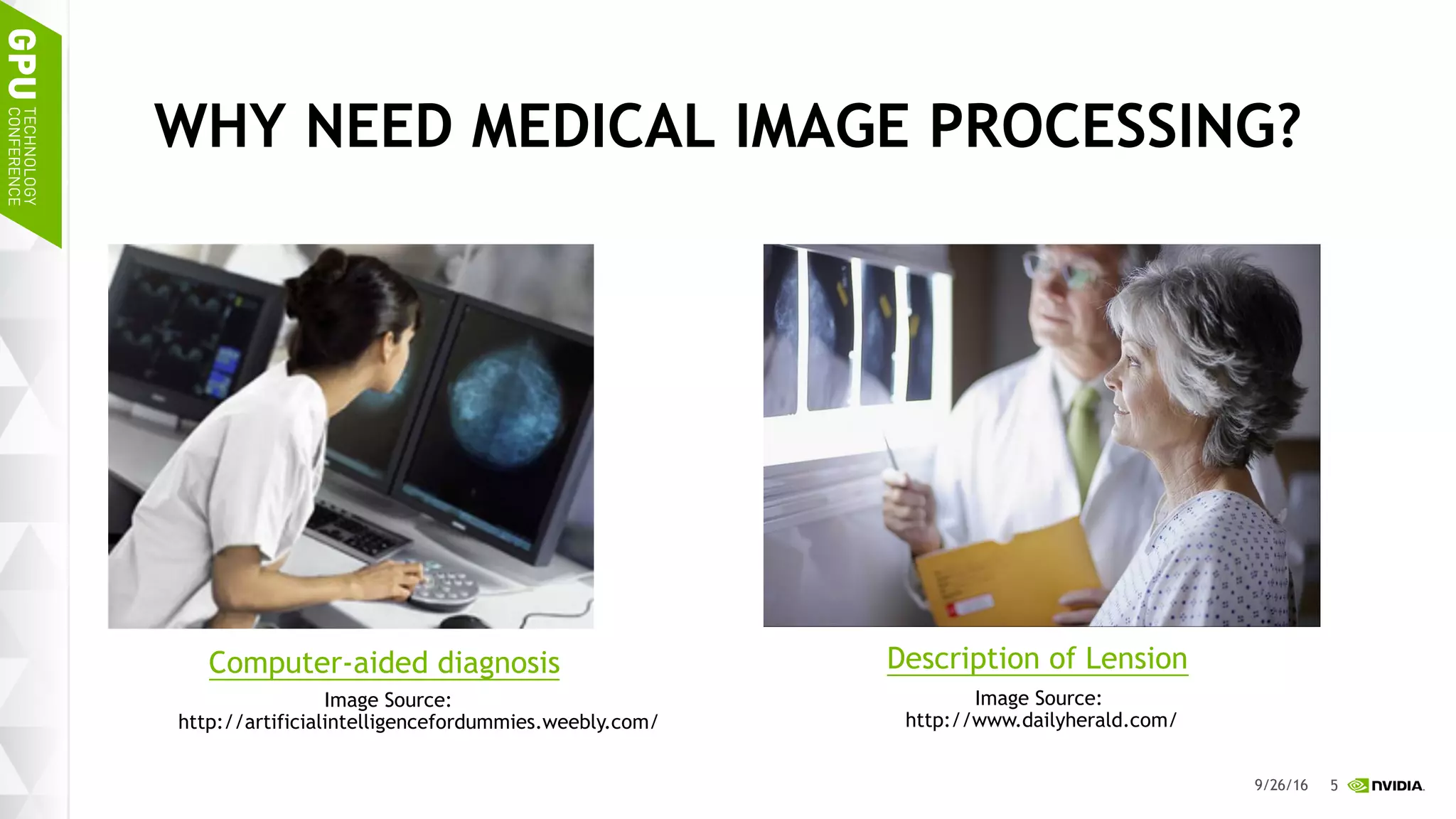 5
WHY NEED MEDICAL IMAGE PROCESSING?
9/26/16
Computer-aided diagnosis Description of Lension
Image Source:
http://www.dailyherald.com/
Image Source:
http://artificialintelligencefordummies.weebly.com/
 