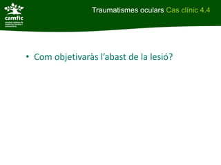 Traumatismes oculars Cas clínic 4.4




• Com objetivaràs l’abast de la lesió?
 