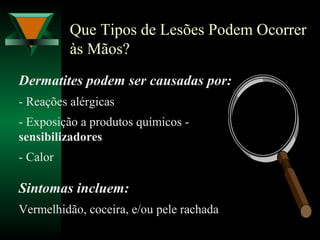 Que Tipos de Lesões Podem Ocorrer
às Mãos?
Dermatites podem ser causadas por:
- Reações alérgicas
- Exposição a produtos químicos -
sensibilizadores
- Calor
Sintomas incluem:
Vermelhidão, coceira, e/ou pele rachada
 