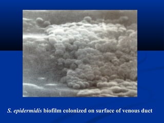 S. epidermidis biofilm colonized on surface of venous duct
 