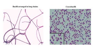 Bacilli arranged in long chains Coccobacilli
 