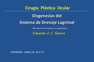 Disgenesias del
Sistema de Drenaje Lagrimal
Eduardo J. C. Soares
Cirugía Plástica Ocular
Mis casos, las conductas y la experiencia.
LEGENDAS : Slides 25, 26 e 27.
 