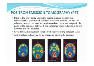 POSITRON EMISSION TOMOGRAPHY (PET) 
  Prior to the scan being taken, the person is given a sugar‐like 
   substance that contains a harmless radioactive element.  When this 
   substance enters the bloodstream it travels to the brain.  As particular 
   parts of the brain are activated, the substance emits radiation which is 
   detected the PET scanner. 
  Great for examining brain function when performing diﬀerent tasks 
  As it involves radioactive element regular use is to be avoided 
 