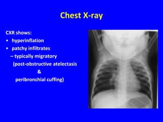 Chest X-ray
CXR shows:
• hyperinflation
• patchy infiltrates
  – typically migratory
   (post-obstructive atelectasis
               &
    peribronchial cuffing)
 