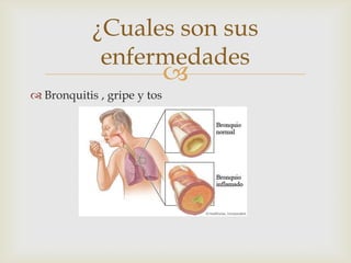 
¿Cuales son sus
enfermedades
 Bronquitis , gripe y tos
 