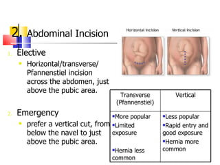 Caesarean section by UM | PPT