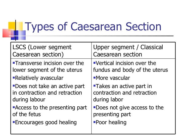 Caesarean section by UM