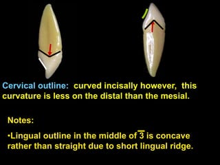 Notes:
•Lingual outline in the middle of 3 is concave
rather than straight due to short lingual ridge.
Cervical outline: curved incisally however, this
curvature is less on the distal than the mesial.
 
