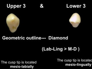 Upper 3 & Lower 3
Geometric outline--- Diamond
(Lab-Ling > M-D )
The cusp tip is located
mesio-labially
The cusp tip is located
mesio-lingually
 