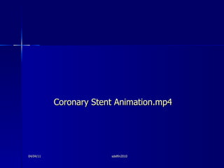 <ul><li>Coronary Stent Animation.mp4 </li></ul>04/04/11 sdelfin2010 