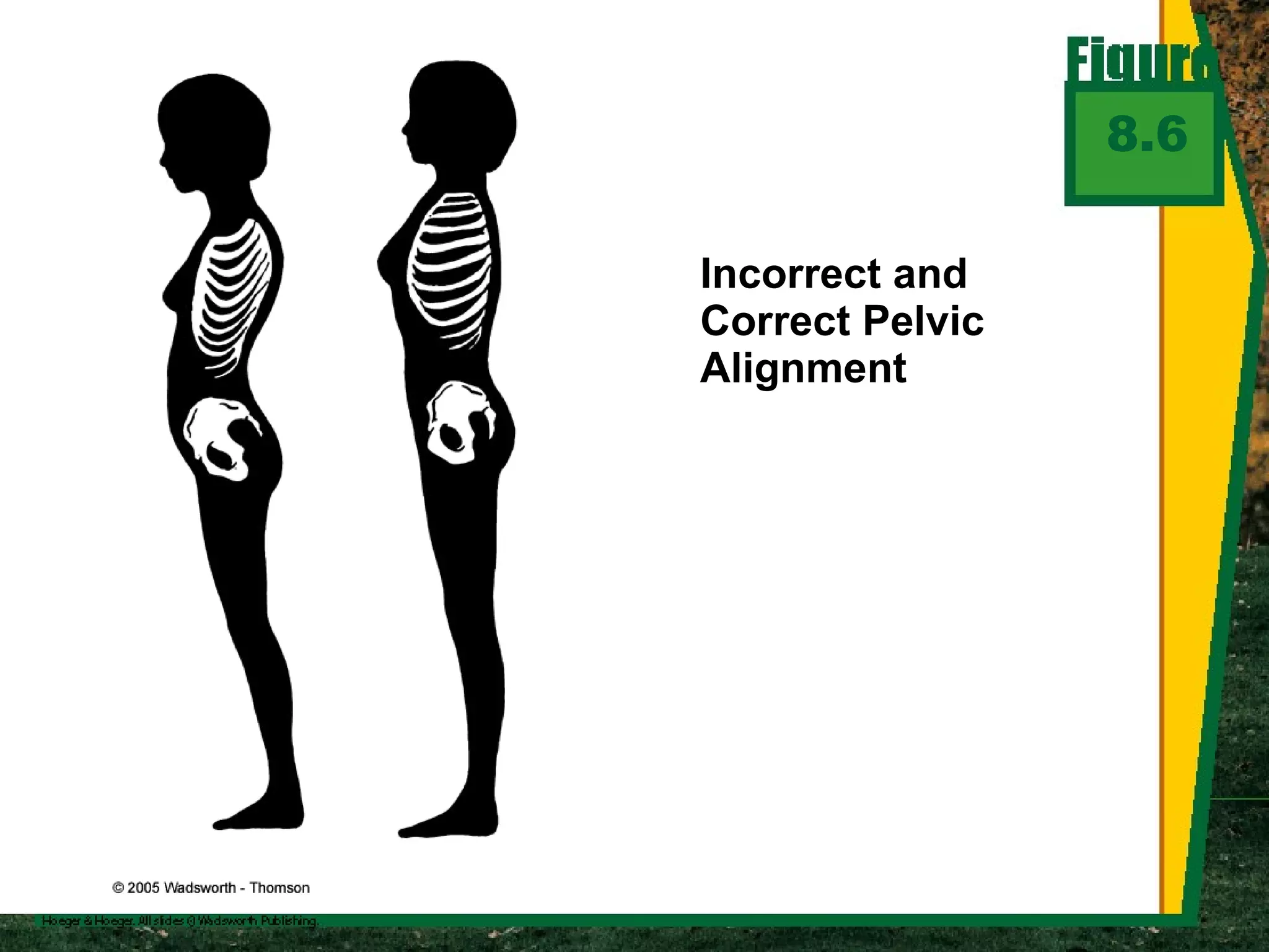 Incorrect and Correct Pelvic Alignment 8.6 