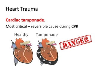 Heart Trauma
Cardiac tamponade.
Most critical – reversible cause during CPR
 