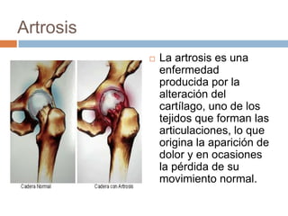 SoluciónIngerir EstrógenosUso de Medicamentos