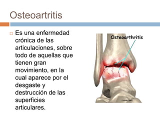 PrevenciónCorrección cuando es posible, de factores desencadenantes o agravantesProteger las articulacionesHacer ejercicio con las articulaciones enfermas es fundamental. Tratamientos con frío y calorMedicamentos 