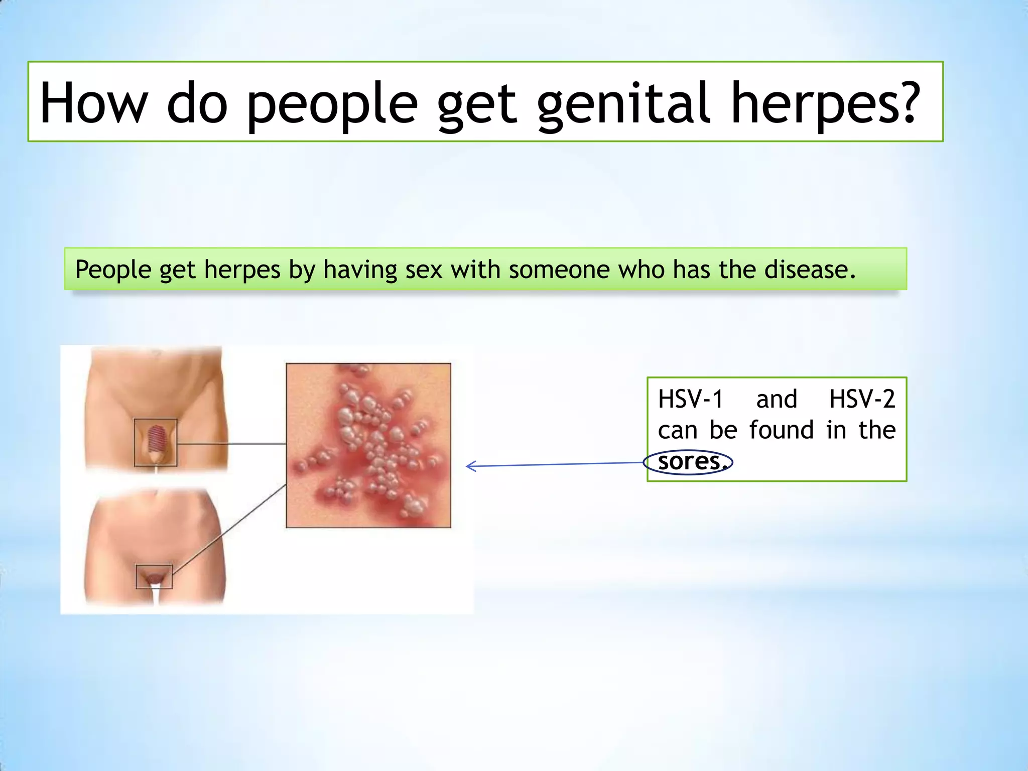 Vip Member Link Can You Have Sex With Someone With Herpes And.not.get It