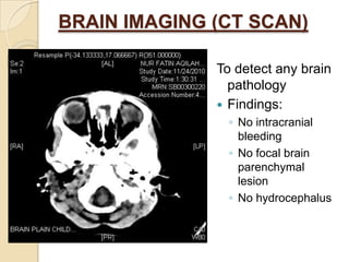 FEEDING HXShe was not breastfed since birth and she was given formula milk instead. She was first introduced to solid foods when she was 6 months old. At that time, she was given Nestum. She started to eat rice at the age of 1 year old. Currently, she is given porridge together with vegetables, fish and sometimes chicken. She is still given the formula milk (DUMEX 123). DUMEX 4 scoops in 4 oz (120ml), 2-3 hourly, prepared by the mother herself.