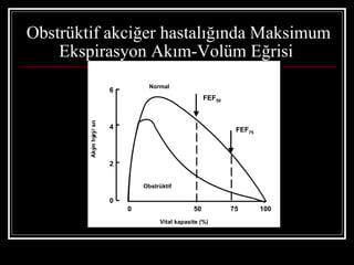 Obstrüktif akciğer hastalığında Maksimum
    Ekspirasyon Akım-Volüm Eğrisi
                                Normal
                      6
                                                    FEF50
        Aký hý / sn




                      4                                      FEF75
          m zý




                      2


                              Obstrüktif

                      0
                          0                    50           75       100
                                   Vital kapasite (%)
 