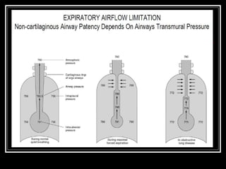 hava yolu rezistansı (fazlası için www.tipfakultesi.org )